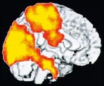 تصویر مغز در حین انجام مدیتیشن